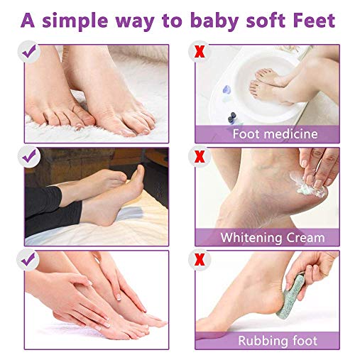 Foot Peeling Mask - 5 Pack, Exfoliating Mask Make Feet Baby Soft, Foot Mask for Dry Cracked Skin, Peeling Away Dead Skin, Calluses - Lavender