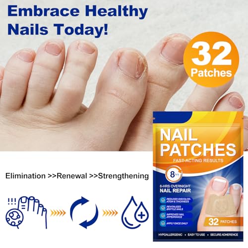 Toenail Treatment Extra Strength-8-Hrs Overnight Nail Repair,ingrown toenail treatment,Strengthens Brittle Nails,Improves Texture & Thickening Hypoallergenic Easy (2 pack 64 Patch)