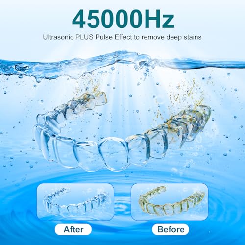 45kHz Ultrasonic Retainer Cleaner Machine – 200ML Dental Cleaning Pod with 4 Wash Modes, Digital Timer for Dentures, Aligners, Mouth Guards, Braces, Jewelry & Toothbrush Heads (White)