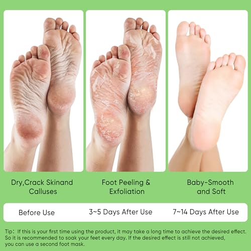 Aloe Vera Foot Peeling Mask, Baby Feet Exfoliating Peel for Dead Skin Removal& Moisturizing Care, Dry Cracked Heels Relief, Softening Rough Feet Spa Socks, 3 Pairs Pack(Unisex)