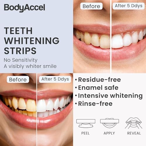 Teeth Whitening Strips, 7/14 Day Treatments, White Strips for Teeth Whitening, Residue-Free, Enamel Safe, Intensive Whitening, Rinse-Free (14 Count)