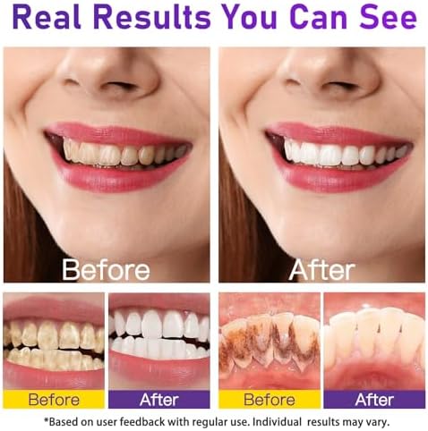 Teeth Whitening Powder - Teeth Whitening - Removes Stains - No Sensitivity - Enamel-Safe Toothpaste Power - Breath Freshener - for Coffee, Tea and Tobacco Stains 15g