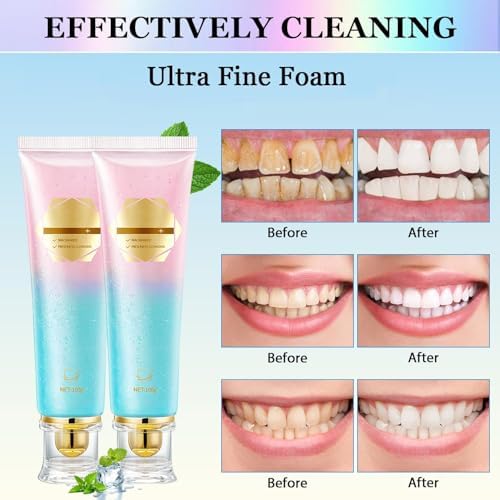 Acssart Radiant Whitening Toothpaste, Nicotinamide Dazzle Toothpaste, Intensive White Toothpastes, Nicotinamide White Toothpastes, Deep Cleaning 2pcs