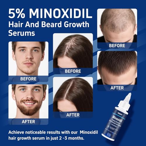 6 Packs, 5% Minoxidil with Biotin, Hair Growth Treatment, Minoxidil Hair and Beard Growth Oil, Minoxidil for Men and Women, Supports Thicker and Fuller Hair & Beard (12 fl oz, 6 Month Supply)