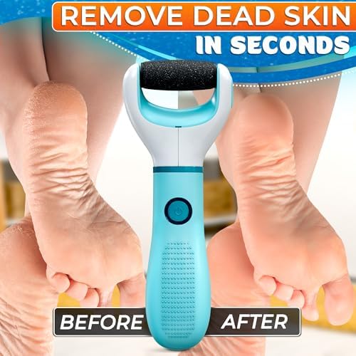 Rechargeable Electric Foot Callus Remover Tool – High-Speed 2800 RPM Electric Foot Sander Callus Remover with Replaceable Roller – Compact & Easy Maintenance, Up to 2-Hour Runtime for Smooth Feet