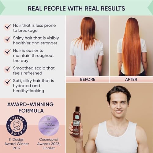 Moerie Hair Growth & Repair Mask - Restorative, Vegan-Friendly Treatment for Longer, Thicker, Fuller Hair - 100ml