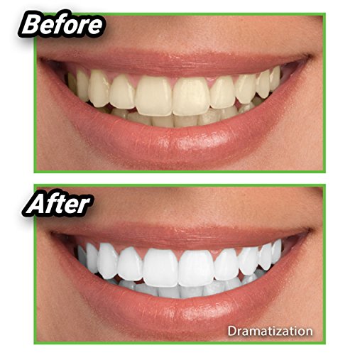 Ontel Miracle Teeth Whitener - Natural Whitening Coconut Charcoal Powder – As Seen on TV