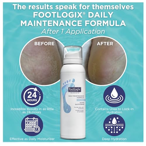 FOOTLOGIX Daily Maintenance Formula - Foot Moisturizer, Foot Mousse for Normal to Dry Skin Maintenance, Foot Mousse for Calluses and Dry Feet, 4.23oz