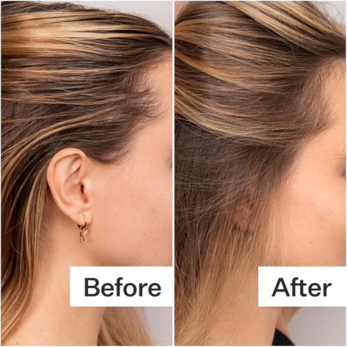 ACT+ ACRE Plant-Based Fulvic Acid Volumizing Dry Shampoo - Natural and Unscented Powder Spray Shampoo with Fulvic Acid and Rice Refresh Oily Hair and Restore Volume - Dry Shampoo for All Hair Types