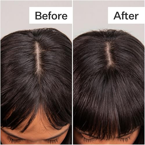 ACT+ ACRE Plant-Based Fulvic Acid Volumizing Dry Shampoo - Natural and Unscented Powder Spray Shampoo with Fulvic Acid and Rice Refresh Oily Hair and Restore Volume - Dry Shampoo for All Hair Types