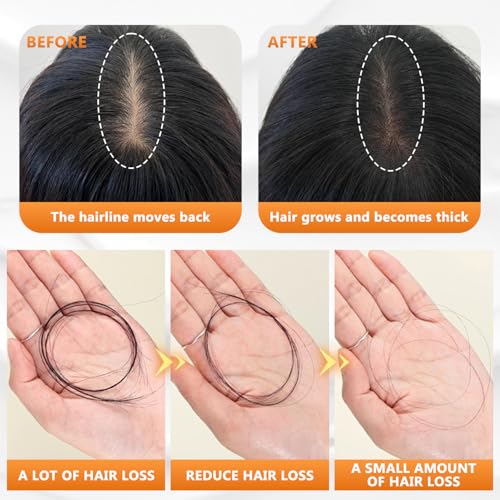 Anti Hair Loss Shampoo for Women, Shampoo for Thinning Hair for Women, Moisturizing & Promoting Hair Growth, 100ML(2PCS)