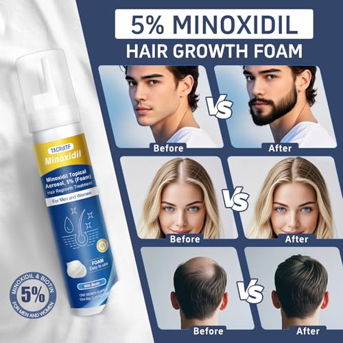 4 Packs Minoxidil Foam, 5% Minoxidil for Men and Women, Infused with Biotin, Hair Growth Treatment, Supports Thicker and Fuller Hair & Beard, Upgraded version (Minoxidil Foam 8.44Oz, 4-Month Supply)