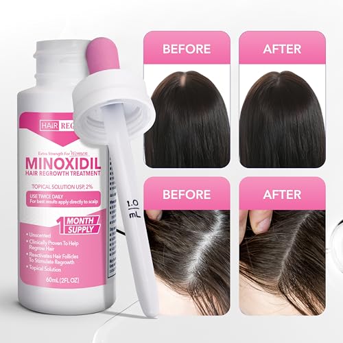 Advanced 2% Minoxidil For Women, Hair Regrowth Treatment for Thinning Hair, Hair Loss for Women,6 Month Supply, Minoxidil Topical Solution for Thicker Fuller Hair