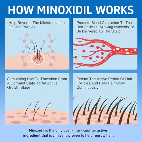 6 Packs, 5% Minoxidil with Biotin, Hair Growth Treatment, Minoxidil Hair and Beard Growth Oil, Minoxidil for Men and Women, Supports Thicker and Fuller Hair & Beard (12 fl oz, 6 Month Supply)