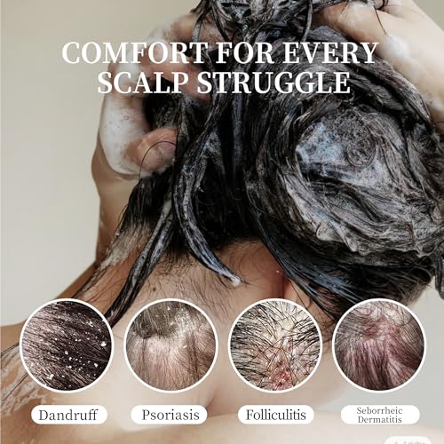 Dandruff Shampoo for Men and Women, Anti-Fungal Shampoo for Psoriasis & Seborrheic Dermatitis – Scalp Treatment for Itching, Flaking & Redness Relief, 300ML