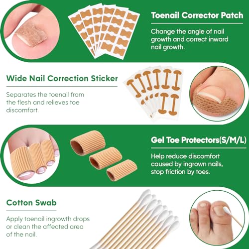 Ingrown Toenail Tools Kit, Ingrown Toenail Treatment, Stainless Steel Ingrown Toenail Removal Kit, Ingrown Toenail Corrector, Corrector Patch, Toenail Clipper, Nail File Lifter Pedicure Tool