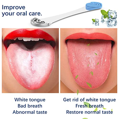 2PCS Tongue Scrapers, Reduce Bad Breath Tongue Cleaner, BPA Free, Get Rid of White Tongue, Dentist Rcommends Tongue Brushes