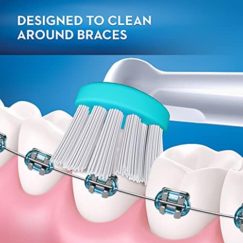 Oral-B Electric Toothbrush Replacement Head, Ortho, 1 Count (Pack of 1), White, for Braces, Compatible with Oral-B Vitality, Precision Clean, TriZone, Braun Electric Toothbrush