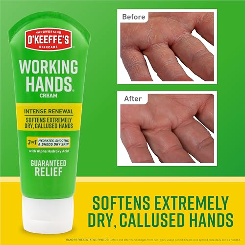 O'Keeffe's Working Hands Intense Renewal Hand Cream, 3 oz Tube (Pack of 1) - Softens and Smooths Extremely Callused, Dry Hands
