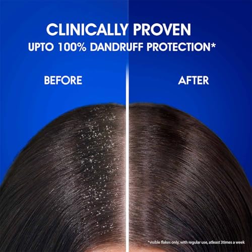 Head & Shoulders Anti Dandruff Cool Menthol Shampoo, 340ml