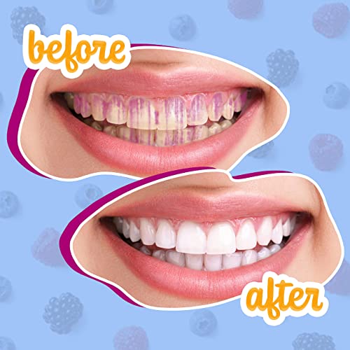 Lingito Plaque/Dental Disclosing Tablets, A Teeth Coloring Tablets Plaque Finder Solution to Effectively Remove Plaque and Tartar Buildup, Improves Oral Care (4 Month Supply - 120 Pack)