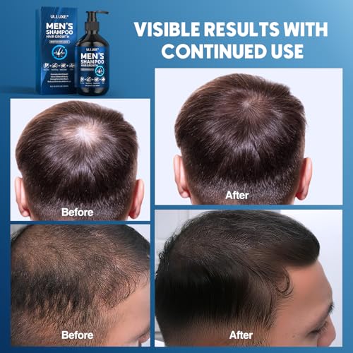 Biotin Hair Growth Shampoo for Men: Natural Mens Thickening Shampoo for Hair Loss and Thinning Hair, Infused Rosemary Oil Tea Tree Oil and Mint, Sulfate Free and Color Safe, 10.15 fl.oz