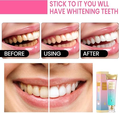 Niacinamide Whitening Toothpaste, BodyAccel Toothpaste, Niacinamide Toothpaste, Stain Removal Toothpaste Natural Gentle, Fresh Breath