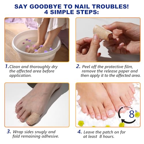 Toenail Treatment Extra Strength-8-Hrs Overnight Nail Repair,ingrown toenail treatment,Strengthens Brittle Nails,Improves Texture & Thickening Hypoallergenic Easy (2 pack 64 Patch)