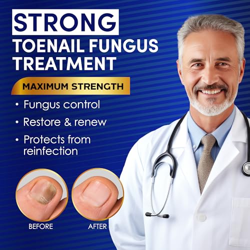Toenail Fungus Treatment Extra Strength – Nail & Toe Solution with Undecylenic Acid 25% and Tea Tree Oil
