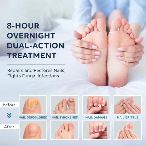 Toenail Treatment Liquid and Patches: Fast Acting Kit for Nail Repair - Extra Strength Solution for Damaged Thick Discolored Cracked Nails - Overnight Toe Finger Nail Renewal Patch