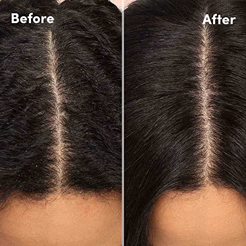 MIZANI Scalp Care Dandruff Shampoo - Cleanses Hair & Scalp, For Curly Hair