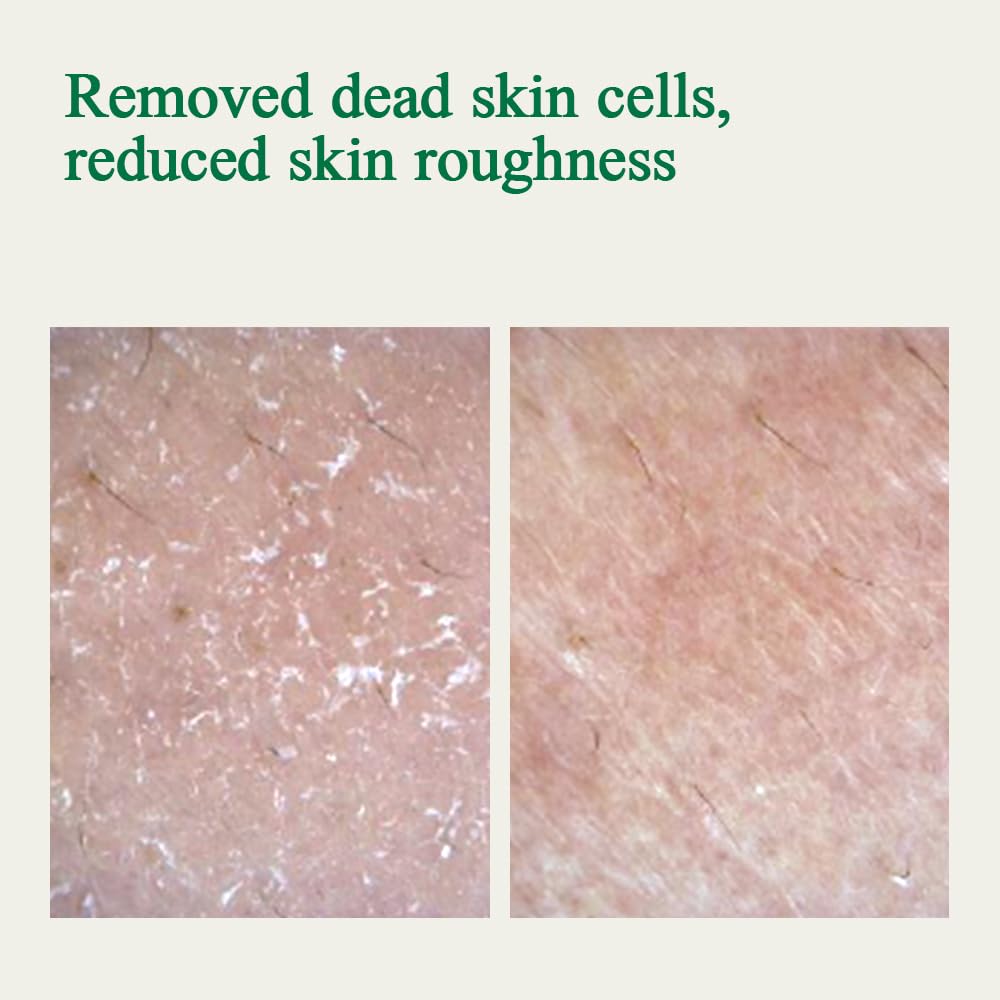 [PKY] Pyunkang Yul Ultimate Calming Solution Toner for Sensitive Skin with Patented Ingredietns, Intensely Calms & Soothes Redness with CICA & Tea Tree, Korean Skincare (3.71 Fl. Oz, 110ml)