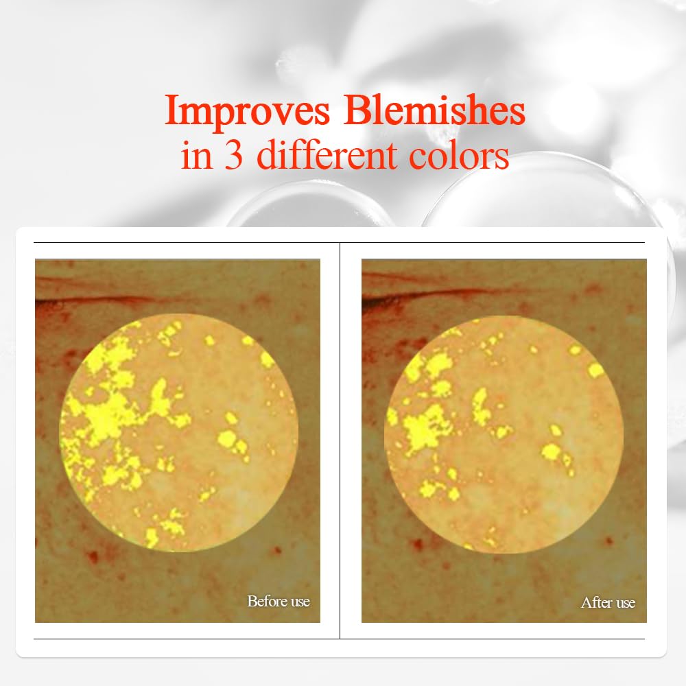 [PKY] Pyunkang Yul Vita Toner for Flawless and Radiant Skin, Blemish Care Toner with Vitamin C & Niacinamide, Zero Irritation, Korean Skincare (5.07 Fl. Oz, 150ml)