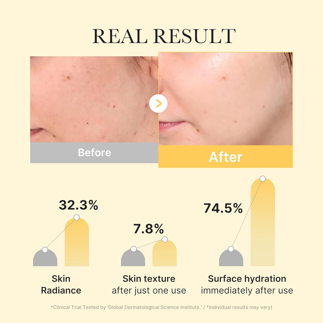 Kojic Acid & Turmeric Brightening Gel Mask | Overnight Hydrating Mask for Glass Skin | Korean Skincare, 28g x 4