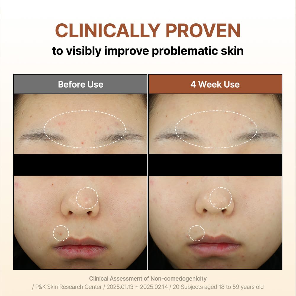 "BY WISHTREND Mandelic Acid 5% Skin prep Water, Gentle Skin exfoliator for face, Ideal for Sensitive Skin | Helping clogged pores and Pigmentation (4.05 Fl Oz - 120ml (Pack of 1)