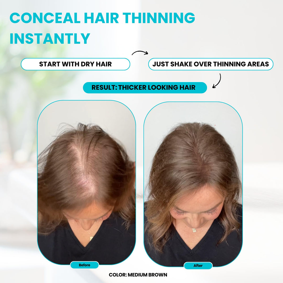 SURETHIK Medium Brown Hair Fibers for Thinning , Building Hair Fibers, Instantly Fuller Looking for Men & Women, 30g