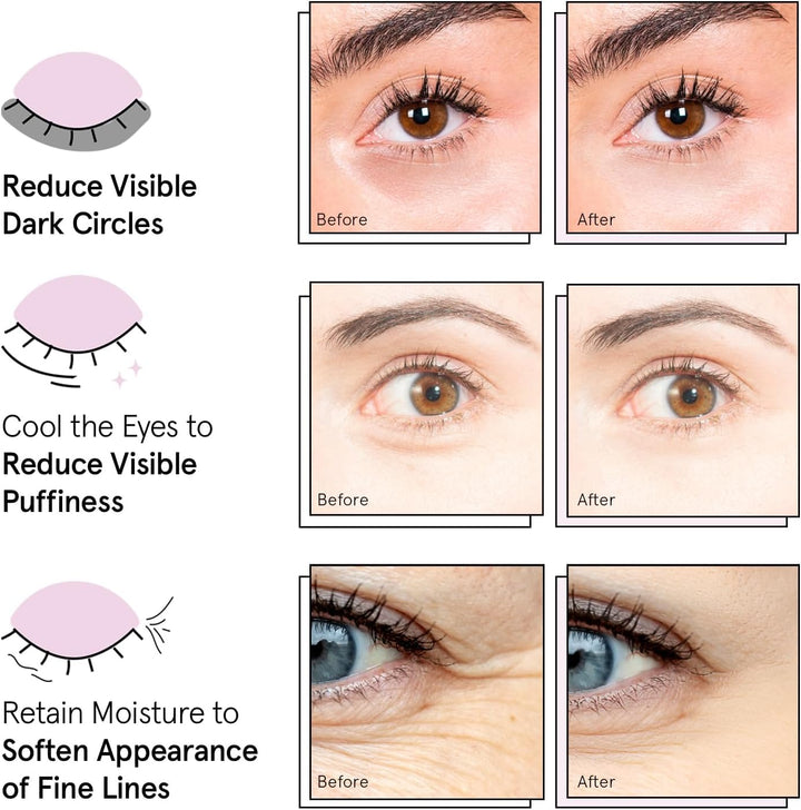 Under Eye Mask Patches | Reduce Dark Circles & Puffiness | Vegan Gel (72 Pairs)