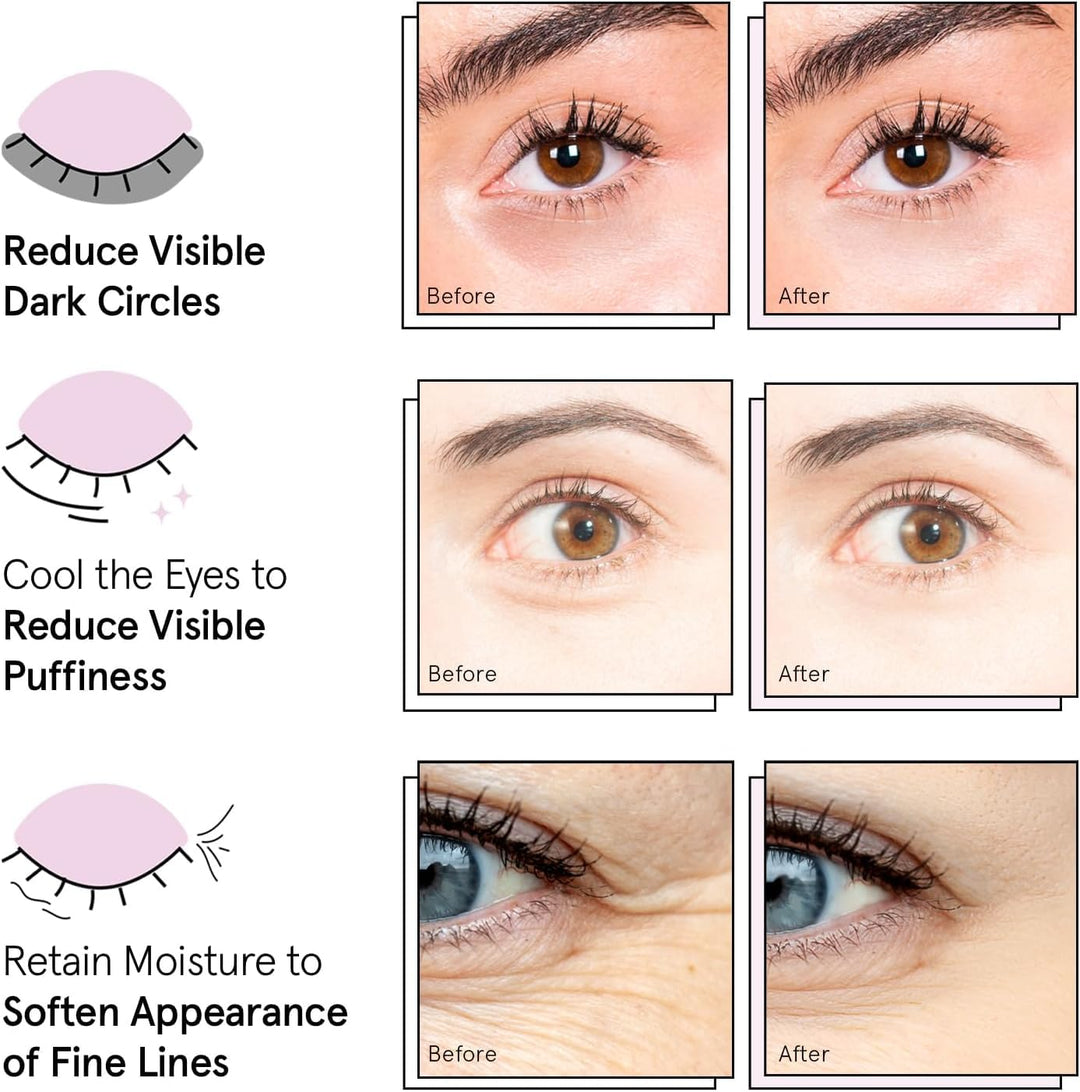 Under Eye Mask Patches | Reduce Dark Circles & Puffiness | Vegan Gel (72 Pairs)