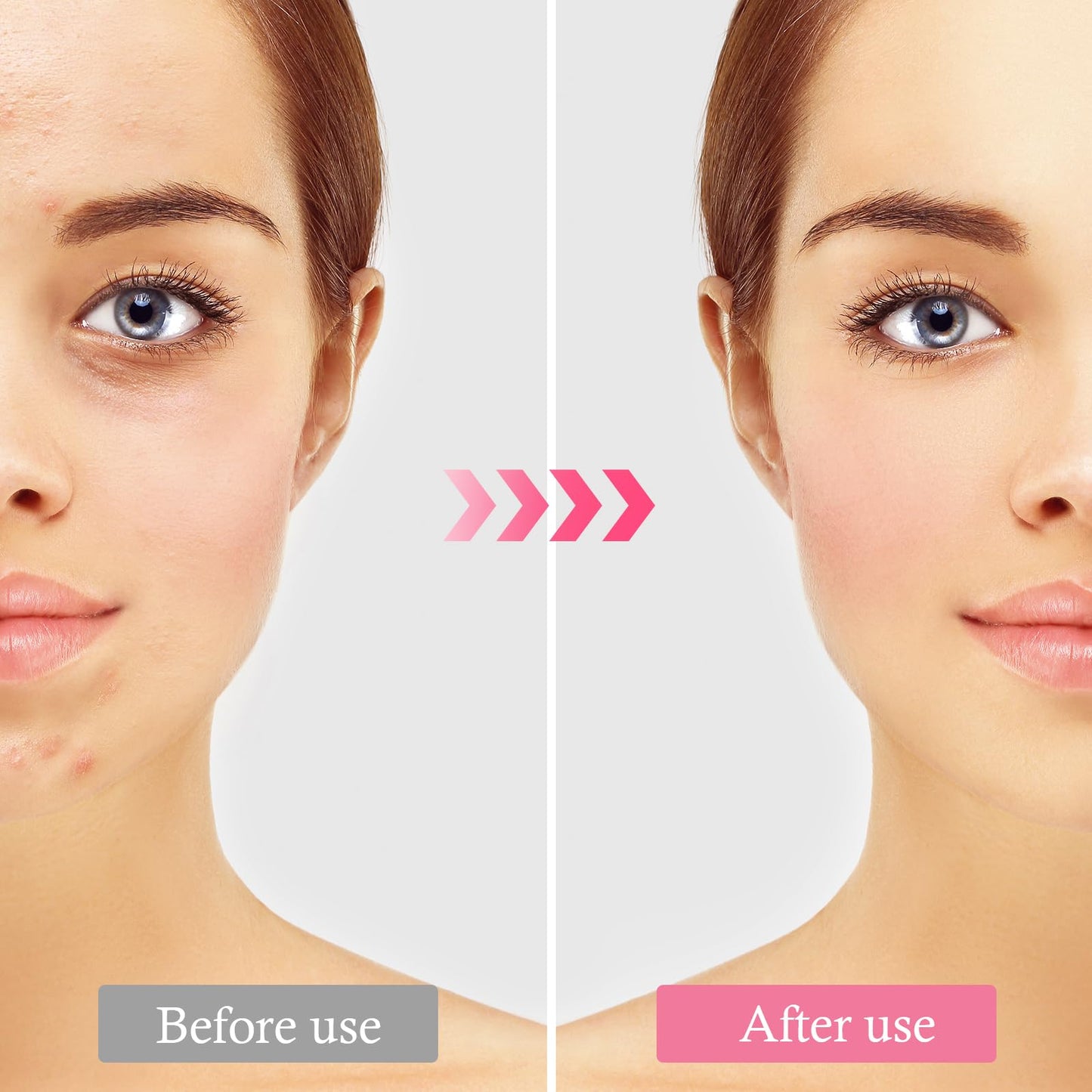 2 Pcs Face Scrubber Silicone Skincare Face Brush Cleanser Facial Cleansing Brushes for Cleaning and Exfoliating, Makeup Residues Removal