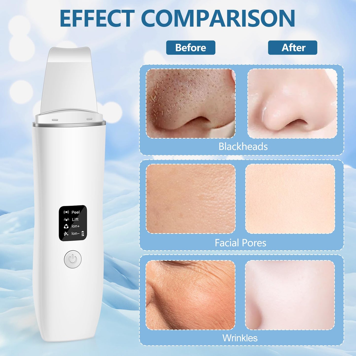 ACWOO Skin Scrubber, Ultrasonic Skin Spatula Blackhead Remover with 4 Modes, USB Rechargeable Facial Pore Cleaner Comedones Extractor Wrinkle Remover, Skin Care Tools for Facial Deep Cleansing