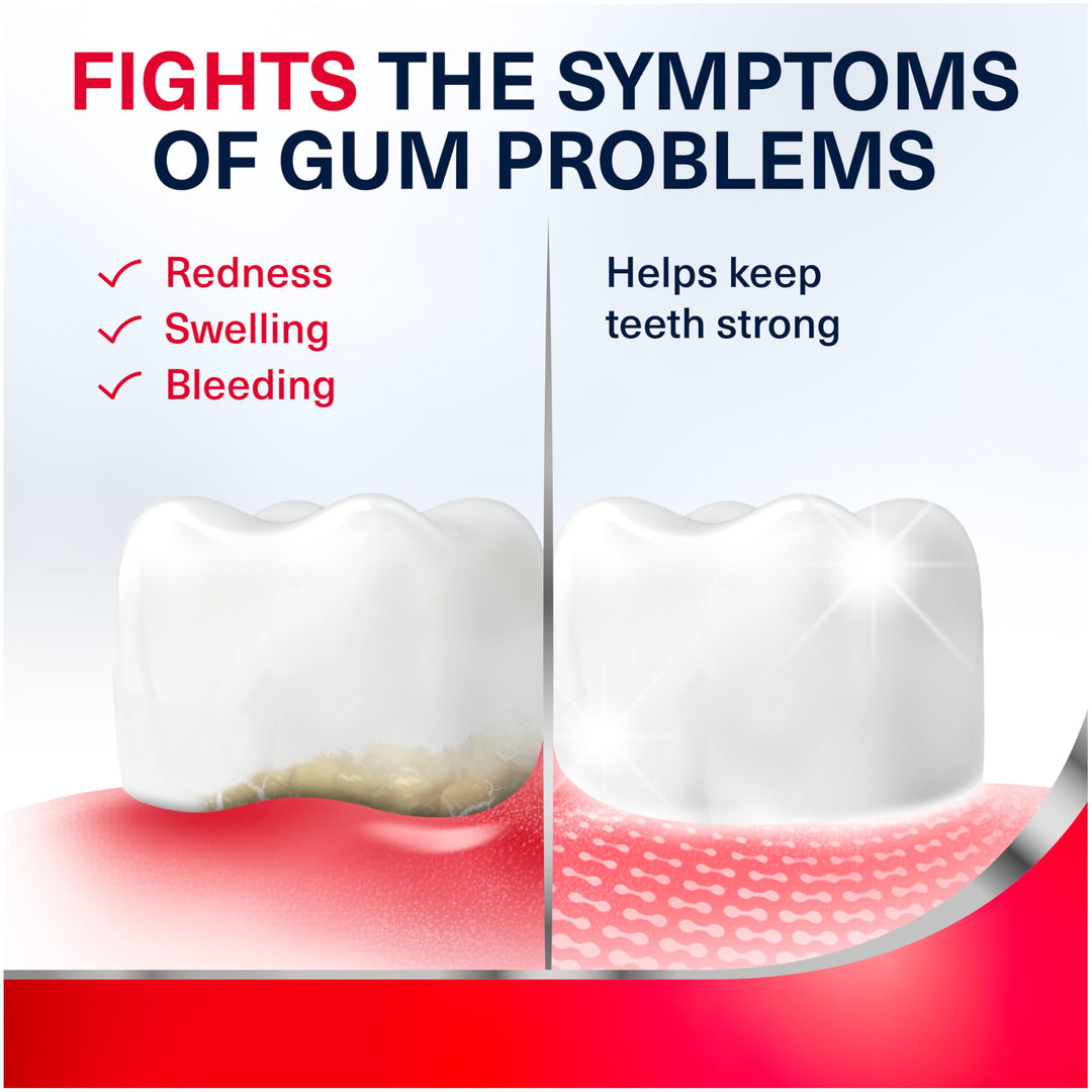 Parodontax Complete Protection Toothpaste for Bleeding Gums, Gingivitis Treatment and Cavity Prevention, Pure Fresh Mint - 3.4 Ounces