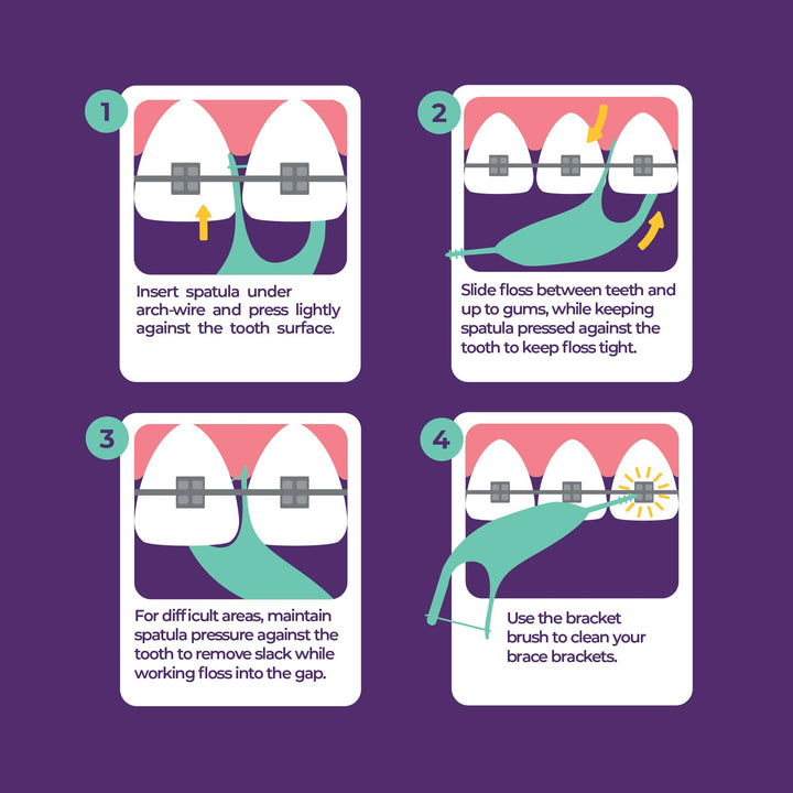 Platypus Orthodontic Flossers for Braces, 40 Count (Pack of 1), Ortho Picks for Adults & Kids, Fits Under Arch Wire, Non-Damaging, Encourage Flossing Habits