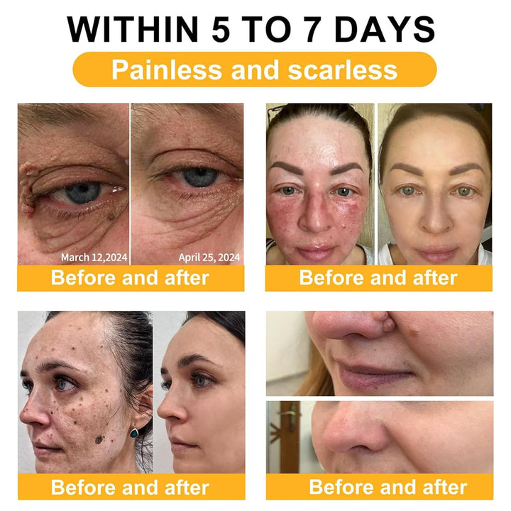 7-Day Multi-Effect All-in-One Skincare Cream BBOJI