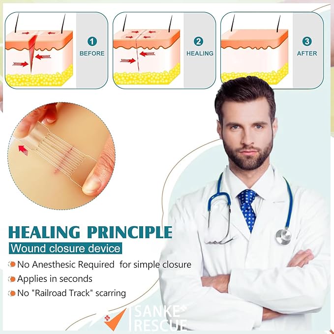 4PCS Emergency Wound Closure Strips Laceration Closure Kit Repair Wounds Without Stitches Elastic Skin Clean Cover Closure Device Sutures Butterfly Bandaids First Aid Kit