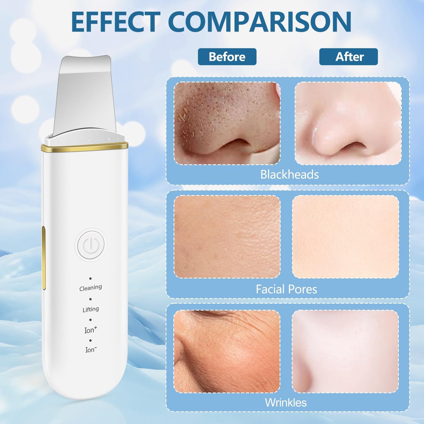 ACWOO Skin Scrubber, Ultrasonic Skin Spatula Blackhead Remover Pore Cleaner with 4 Modes, USB Rechargeabl Comedones Extractor, Skin Care Tools for Facial Deep Cleansing - 2 Silicone Covers Included