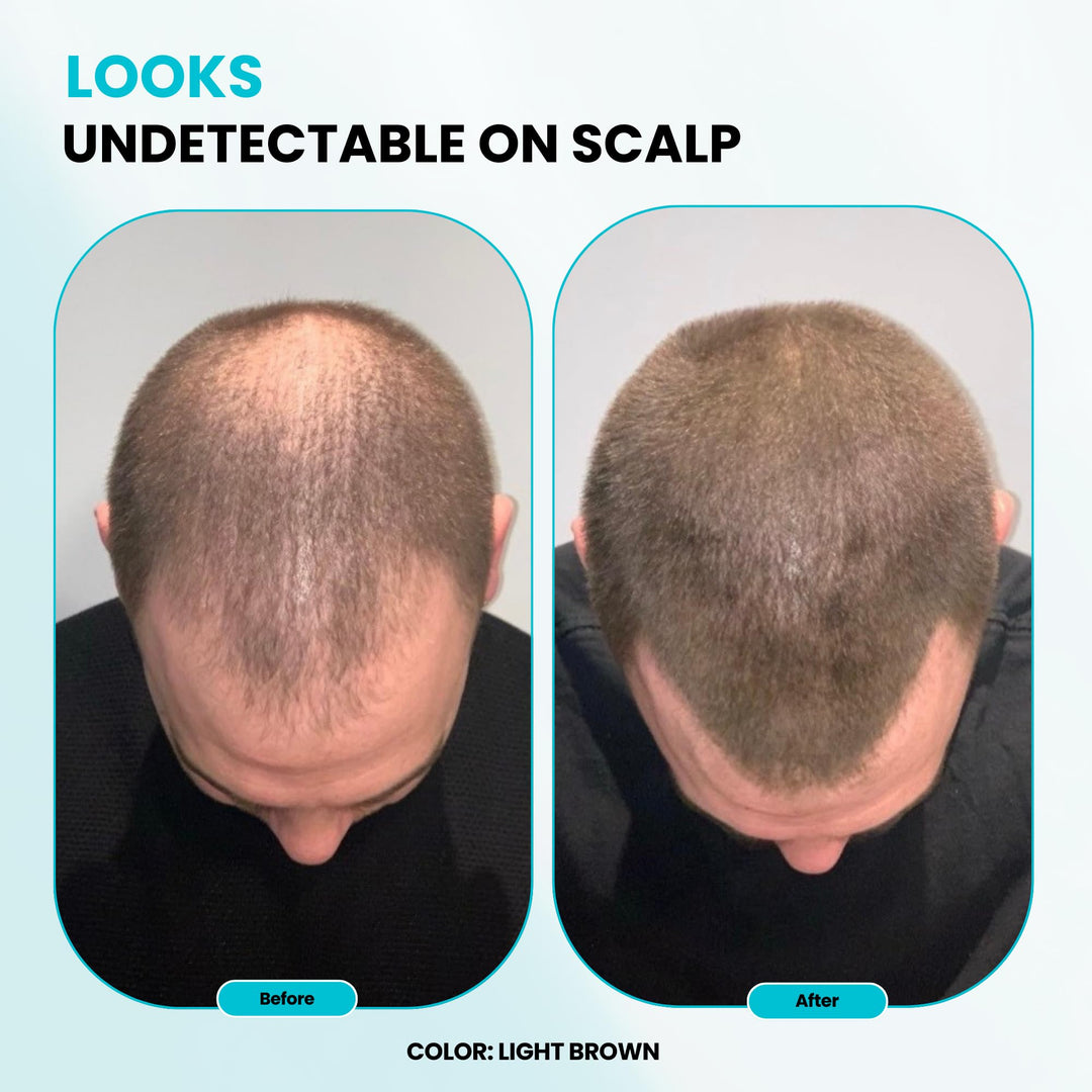 SURETHIK Medium Brown Hair Fibers for Thinning , Building Hair Fibers, Instantly Fuller Looking for Men & Women, 30g