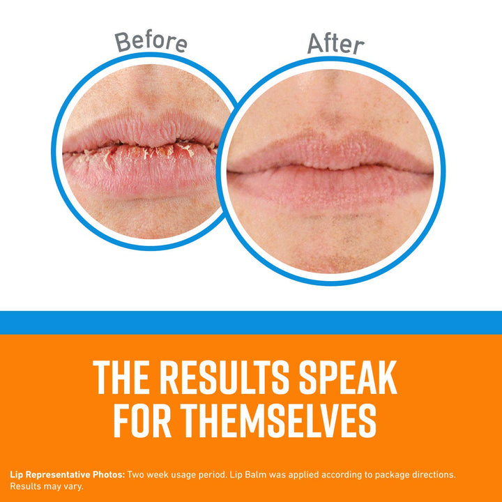 O'Keeffe's Lip Repair Lip Balm With Cooling Relief for Dry, Cracked Lips - Stick (Twin Pack) - Moisturizer for Extremely Cracked, Dry Lips