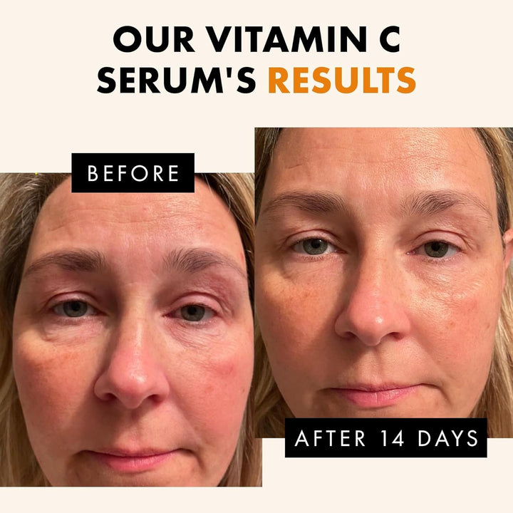 Vitamin C Face Serum | Anti-Aging & Skin Brightening | 30ml | Eclat Skincare