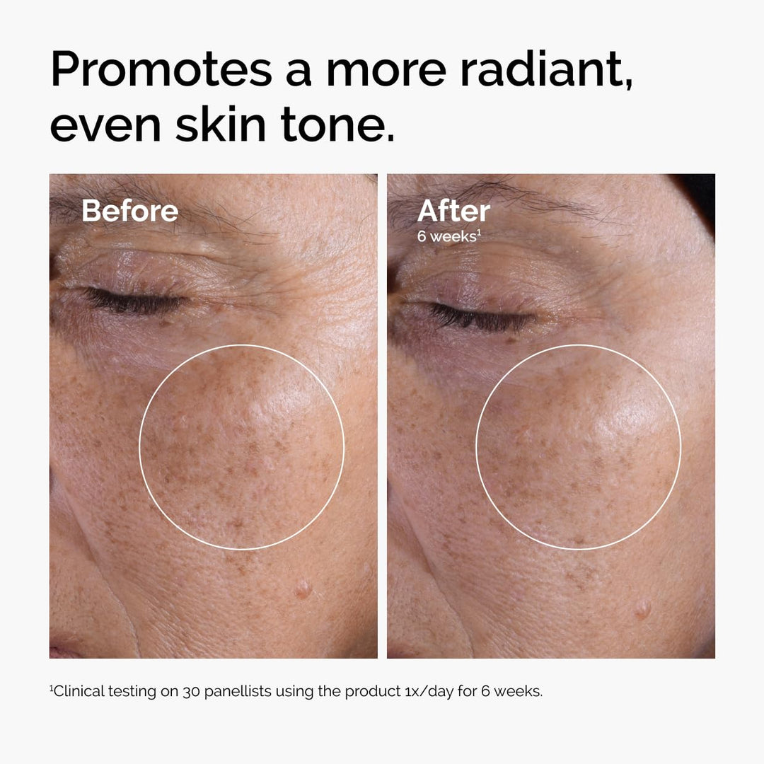 The Ordinary Glycolic Acid 7% Exfoliating Toner, Brightening and Smoothing Daily Toner for More Even-Looking Skin Tone, 3.4 Fl Oz