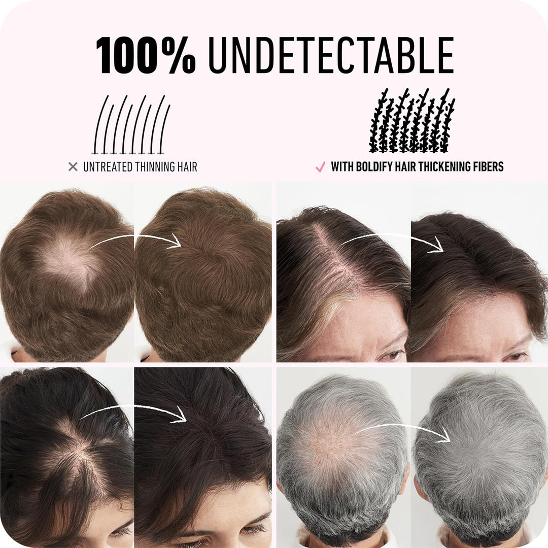 Boldify Hair Fibers 28g | Fill Thinning Hair | Light Brown | For Men & Women